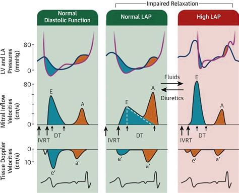 left ventricular diastolic function symptoms